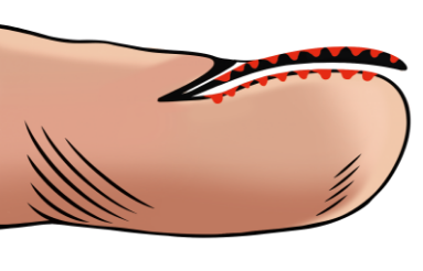 Toe